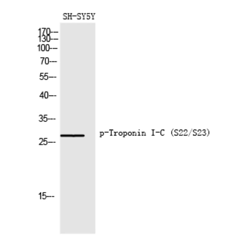 Western blot - Troponin I-C (Phospho-Ser22/Ser23) Polyclonal Antibody from Signalway Antibody - Antibodies.com