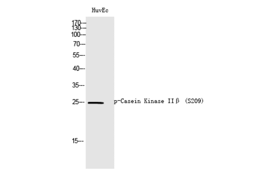 Western blot - Casein Kinase IIβ (Phospho-Ser209) Polyclonal Antibody from Signalway Antibody (12326)
