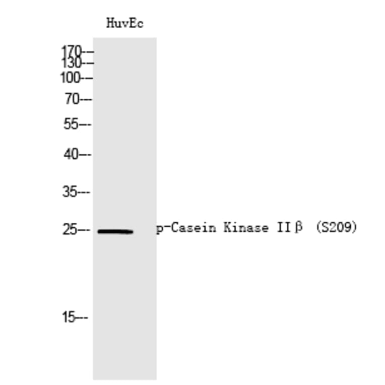Western blot - Casein Kinase IIβ (Phospho-Ser209) Polyclonal Antibody from Signalway Antibody (12326)