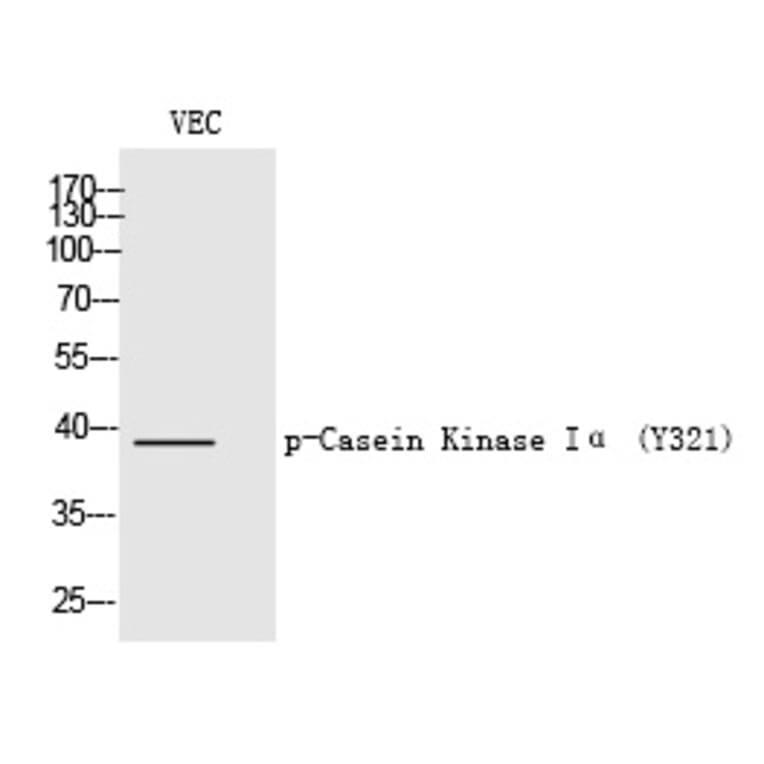 Western blot - Casein Kinase Iα (Phospho-Tyr321) Polyclonal Antibody from Signalway Antibody (12248)