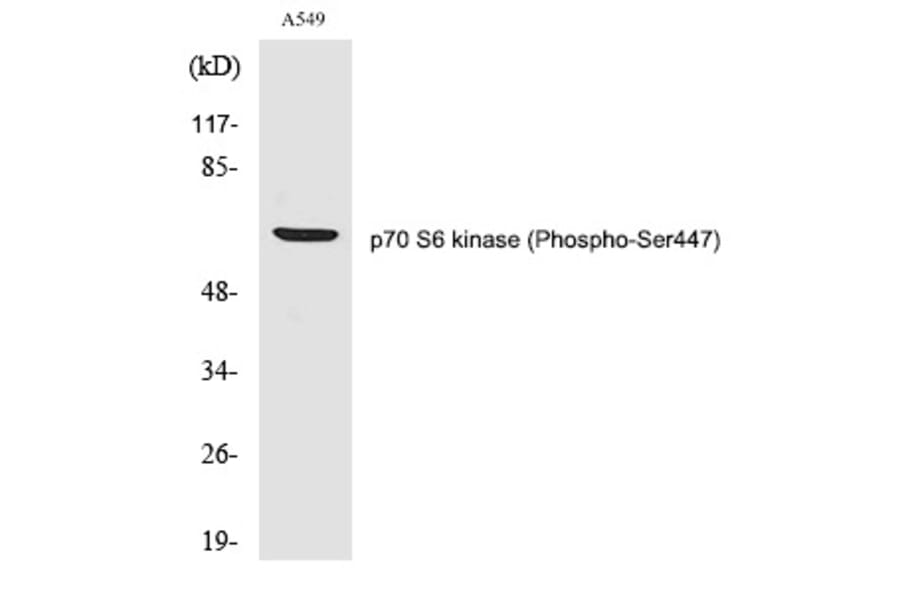 Western blot - p70 S6 kinase α (Phospho-Ser447) Polyclonal Antibody from Signalway Antibody - Antibodies.com
