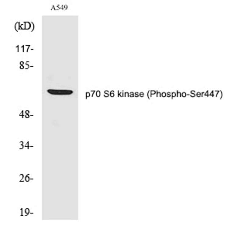 Western blot - p70 S6 kinase α (Phospho-Ser447) Polyclonal Antibody from Signalway Antibody - Antibodies.com