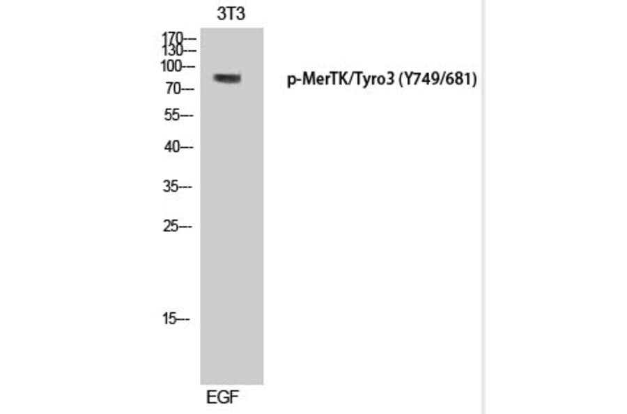 Western blot - MerTK/Tyro3 (Phospho-Tyr749/681) Polyclonal Antibody from Signalway Antibody (12338) - Antibodies.com