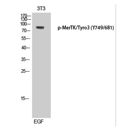 Western blot - MerTK/Tyro3 (Phospho-Tyr749/681) Polyclonal Antibody from Signalway Antibody (12338) - Antibodies.com