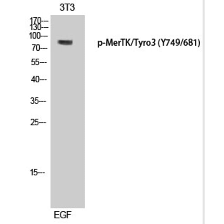 Western blot - MerTK/Tyro3 (Phospho-Tyr749/681) Polyclonal Antibody from Signalway Antibody (12338) - Antibodies.com