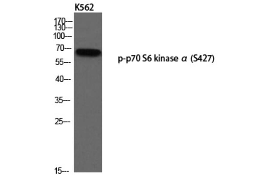 Western blot - p70 S6 kinase α (Phospho-Ser427) Polyclonal Antibody from Signalway Antibody - Antibodies.com