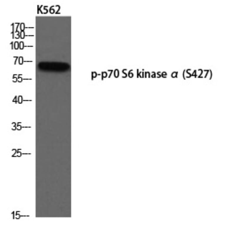 Western blot - p70 S6 kinase α (Phospho-Ser427) Polyclonal Antibody from Signalway Antibody - Antibodies.com