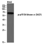 Western blot - p70 S6 kinase α (Phospho-Ser427) Polyclonal Antibody from Signalway Antibody - Antibodies.com