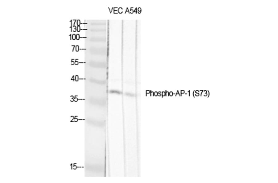 Western blot - AP-1/Jun D (Phospho-Ser73/100) Polyclonal Antibody from Signalway Antibody (12181) - Antibodies.com