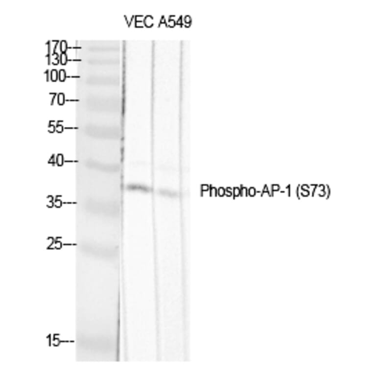 Western blot - AP-1/Jun D (Phospho-Ser73/100) Polyclonal Antibody from Signalway Antibody (12181) - Antibodies.com