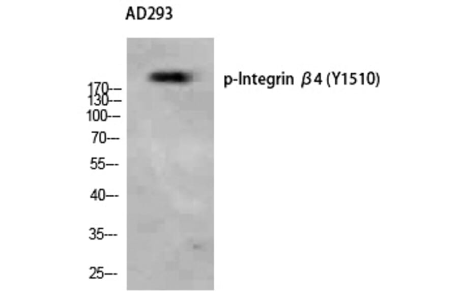 Western blot - Integrin β4 (Phospho-Tyr1510) Polyclonal Antibody from Signalway Antibody - Antibodies.com