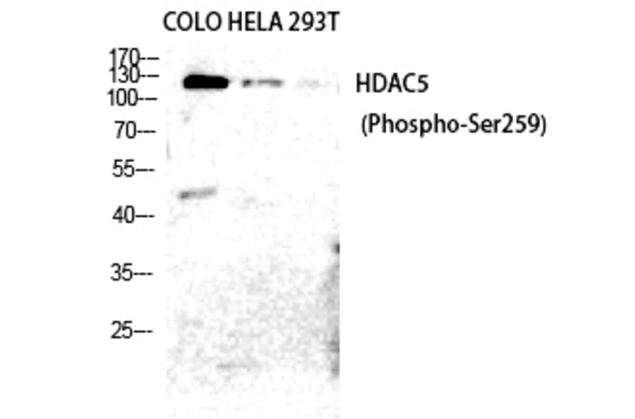 Western blot - HDAC5/9 (Phospho-Ser259/220) Polyclonal Antibody from Signalway Antibody (12226) - Antibodies.com