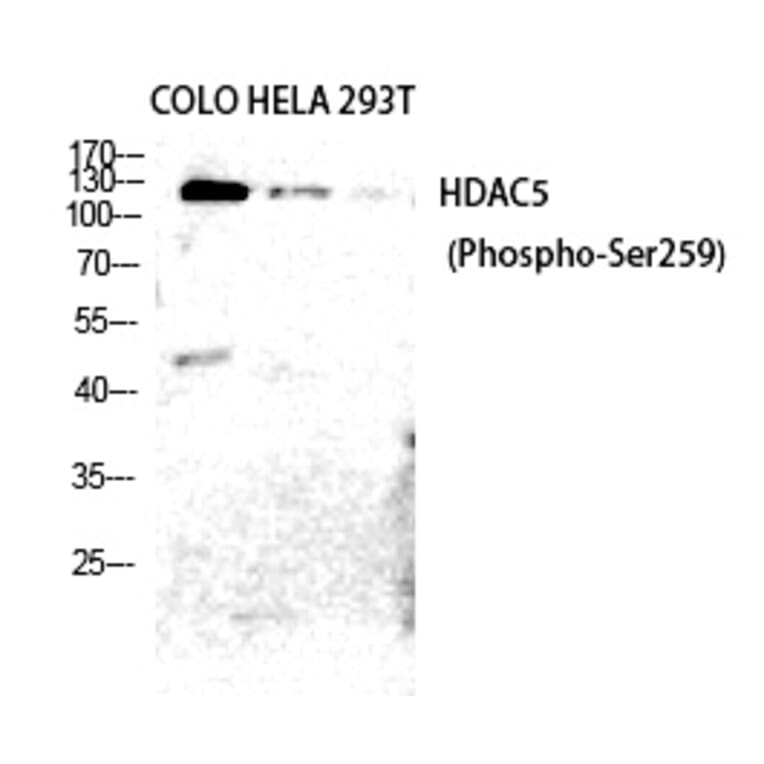Western blot - HDAC5/9 (Phospho-Ser259/220) Polyclonal Antibody from Signalway Antibody (12226) - Antibodies.com