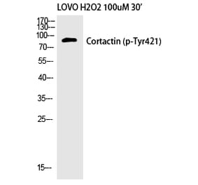 Western blot - Cortactin (Phospho-Tyr421) Polyclonal Antibody from Signalway Antibody (12192) - Antibodies.com