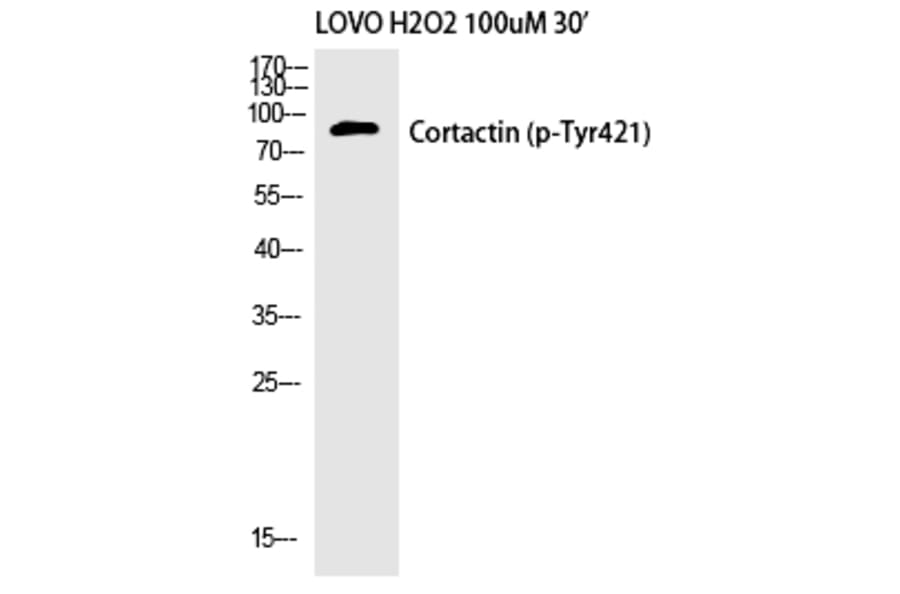 Western blot - Cortactin (Phospho-Tyr421) Polyclonal Antibody from Signalway Antibody (12192) - Antibodies.com