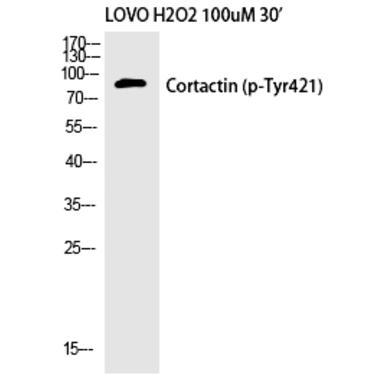 Western blot - Cortactin (Phospho-Tyr421) Polyclonal Antibody from Signalway Antibody (12192) - Antibodies.com