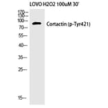 Western blot - Cortactin (Phospho-Tyr421) Polyclonal Antibody from Signalway Antibody (12192) - Antibodies.com