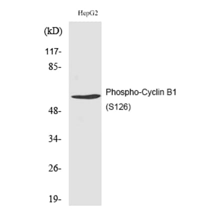 Western blot - Cyclin B1 (Phospho-Ser126) Polyclonal Antibody from Signalway Antibody (12193) - Antibodies.com