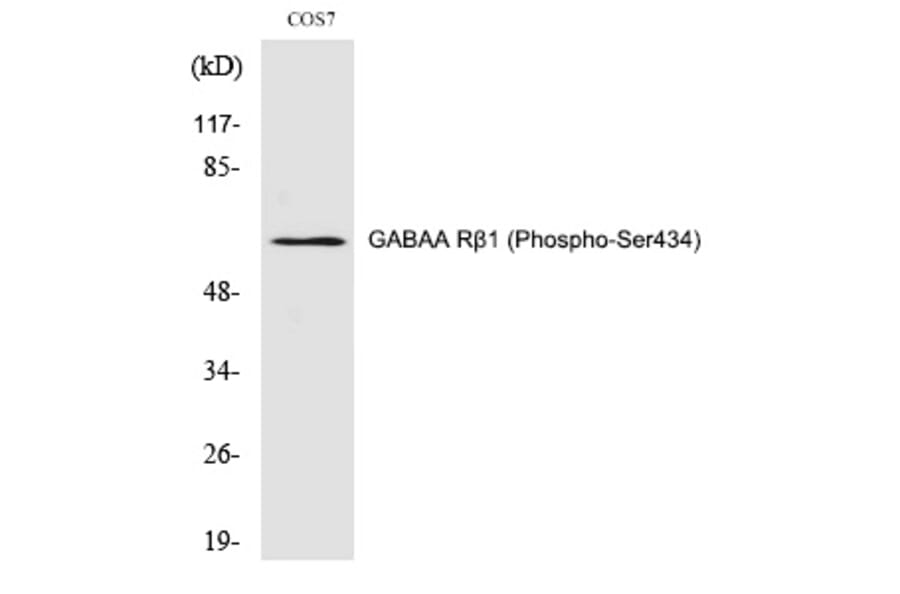 Western blot - GABAA Rβ1 (Phospho-Ser434) Polyclonal Antibody from Signalway Antibody (12278) - Antibodies.com