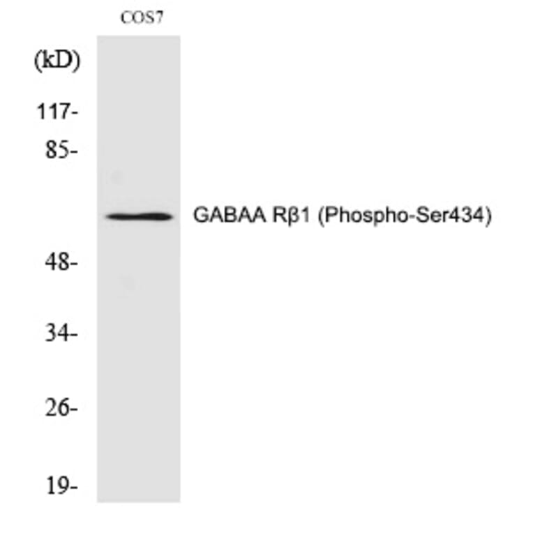 Western blot - GABAA Rβ1 (Phospho-Ser434) Polyclonal Antibody from Signalway Antibody (12278) - Antibodies.com