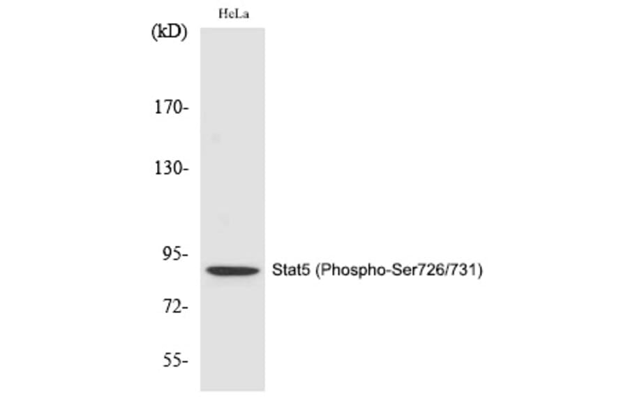 Western blot - Stat5 (Phospho-Ser726/731) Polyclonal Antibody from Signalway Antibody (12292) - Antibodies.com