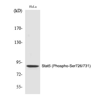 Western blot - Stat5 (Phospho-Ser726/731) Polyclonal Antibody from Signalway Antibody (12292) - Antibodies.com