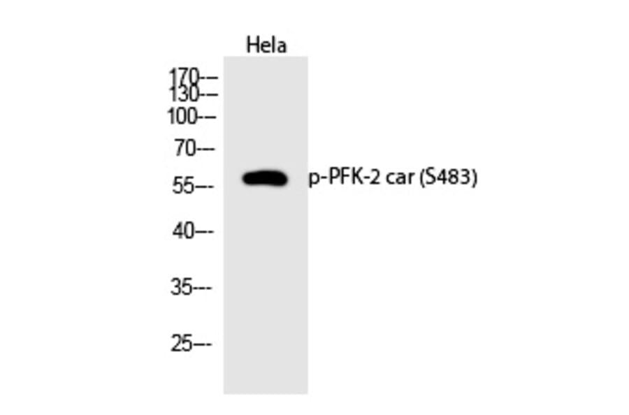 Western blot - PFK-2 car (Phospho-Ser483) Polyclonal Antibody from Signalway Antibody (12319) - Antibodies.com