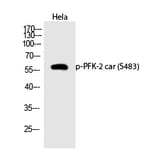 Western blot - PFK-2 car (Phospho-Ser483) Polyclonal Antibody from Signalway Antibody (12319) - Antibodies.com