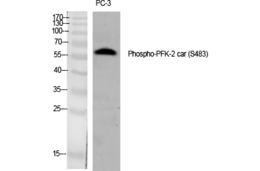 Western blot - PFK-2 car (Phospho-Ser483) Polyclonal Antibody from Signalway Antibody (12319) - Antibodies.com