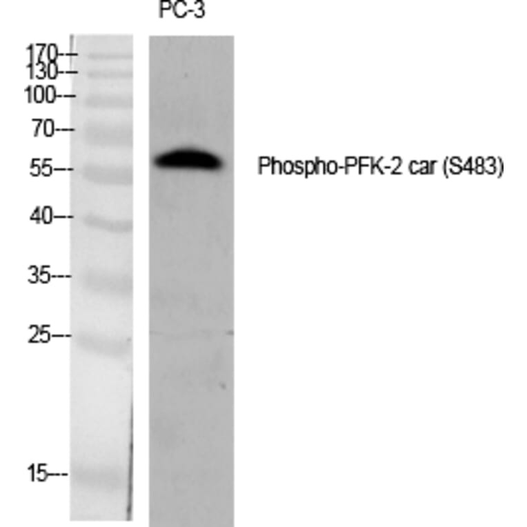Western blot - PFK-2 car (Phospho-Ser483) Polyclonal Antibody from Signalway Antibody (12319) - Antibodies.com