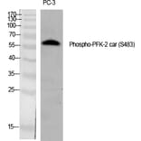 Western blot - PFK-2 car (Phospho-Ser483) Polyclonal Antibody from Signalway Antibody (12319) - Antibodies.com
