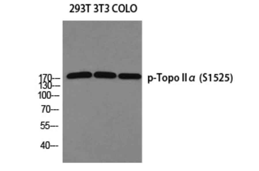 Western blot - Topo IIα (Phospho-Ser1525) Polyclonal Antibody from Signalway Antibody (12344) - Antibodies.com