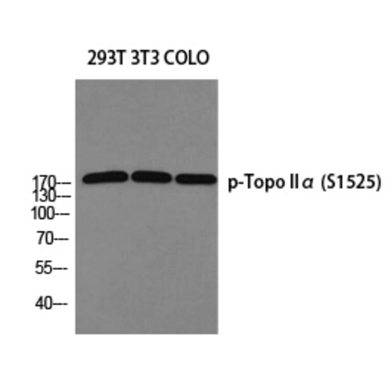 Western blot - Topo IIα (Phospho-Ser1525) Polyclonal Antibody from Signalway Antibody (12344) - Antibodies.com