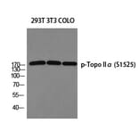 Western blot - Topo IIα (Phospho-Ser1525) Polyclonal Antibody from Signalway Antibody (12344) - Antibodies.com