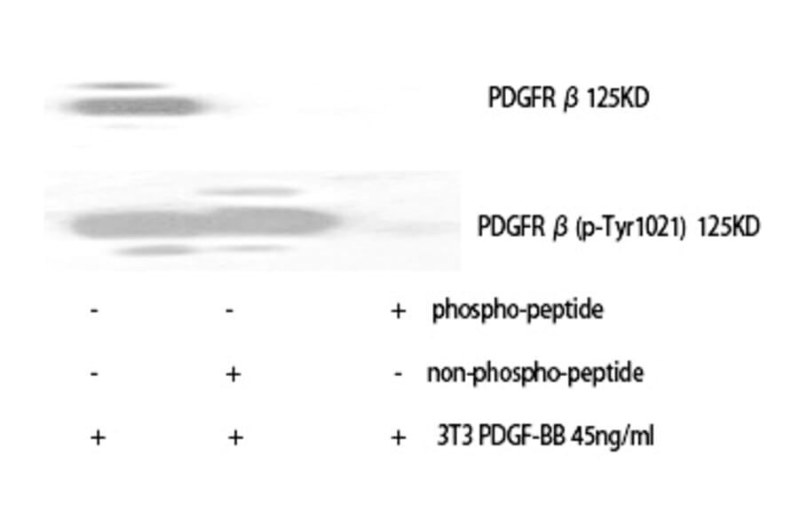 Western blot - PDGFR-β (Phospho-Tyr1021) Polyclonal Antibody from Signalway Antibody (12374) - Antibodies.com