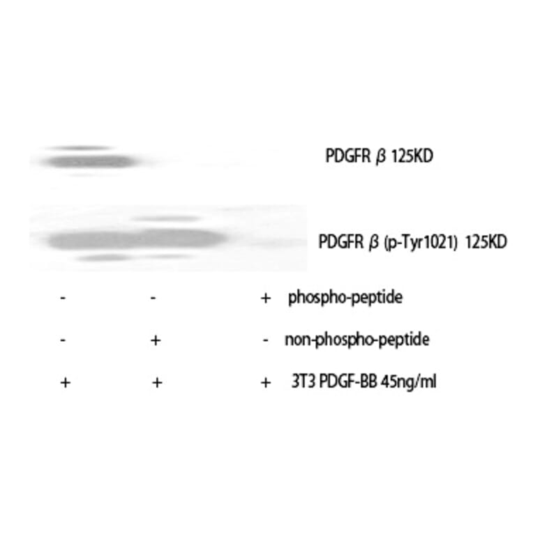 Western blot - PDGFR-β (Phospho-Tyr1021) Polyclonal Antibody from Signalway Antibody (12374) - Antibodies.com