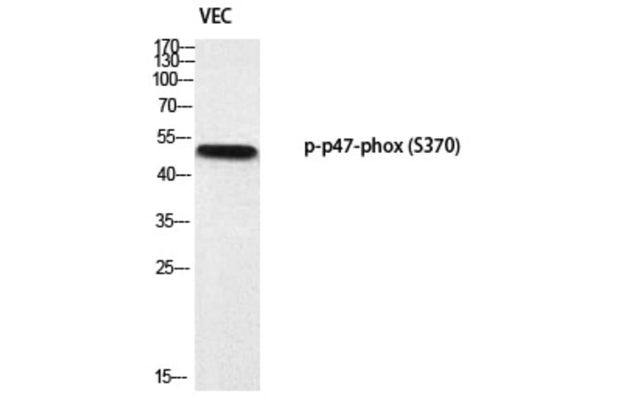 Western blot - p47-phox (Phospho-Ser370) Polyclonal Antibody from Signalway Antibody (12377) - Antibodies.com