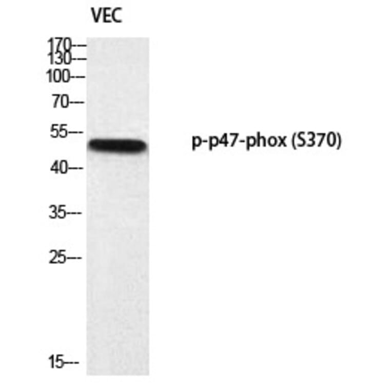 Western blot - p47-phox (Phospho-Ser370) Polyclonal Antibody from Signalway Antibody (12377) - Antibodies.com