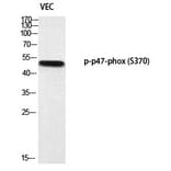 Western blot - p47-phox (Phospho-Ser370) Polyclonal Antibody from Signalway Antibody (12377) - Antibodies.com