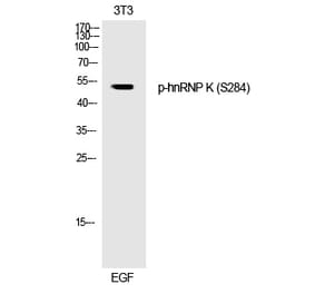 Western blot - hnRNP K (Phospho-Ser284) Polyclonal Antibody from Signalway Antibody (12243) - Antibodies.com