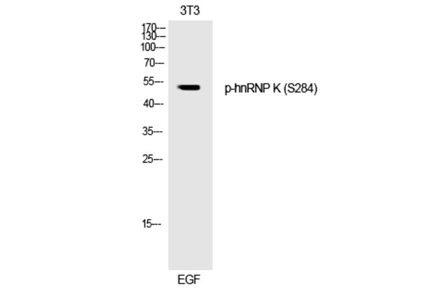 Western blot - hnRNP K (Phospho-Ser284) Polyclonal Antibody from Signalway Antibody (12243) - Antibodies.com