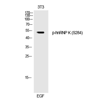 Western blot - hnRNP K (Phospho-Ser284) Polyclonal Antibody from Signalway Antibody (12243) - Antibodies.com