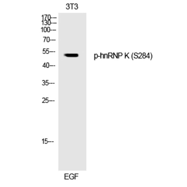 Western blot - hnRNP K (Phospho-Ser284) Polyclonal Antibody from Signalway Antibody (12243) - Antibodies.com