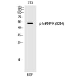 Western blot - hnRNP K (Phospho-Ser284) Polyclonal Antibody from Signalway Antibody (12243) - Antibodies.com