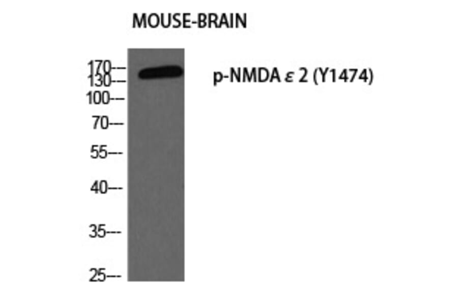 Western blot - NMDAε2 (Phospho-Tyr1474) Polyclonal Antibody from Signalway Antibody (12303) - Antibodies.com