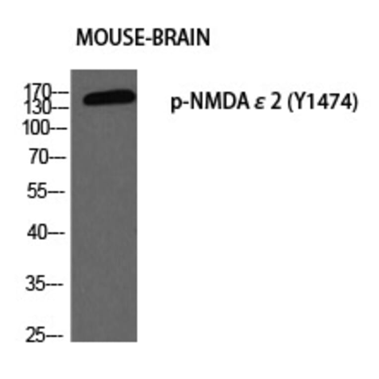 Western blot - NMDAε2 (Phospho-Tyr1474) Polyclonal Antibody from Signalway Antibody (12303) - Antibodies.com