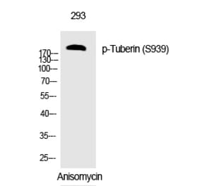 Western blot - Tuberin (Phospho-Ser939) Polyclonal Antibody from Signalway Antibody (12308) - Antibodies.com