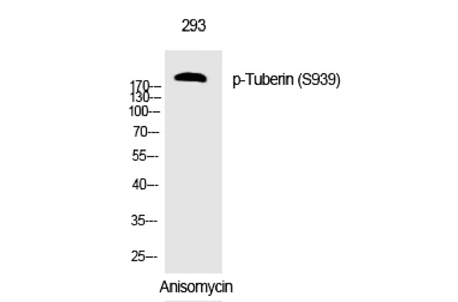 Western blot - Tuberin (Phospho-Ser939) Polyclonal Antibody from Signalway Antibody (12308) - Antibodies.com