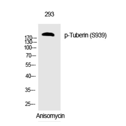 Western blot - Tuberin (Phospho-Ser939) Polyclonal Antibody from Signalway Antibody (12308) - Antibodies.com