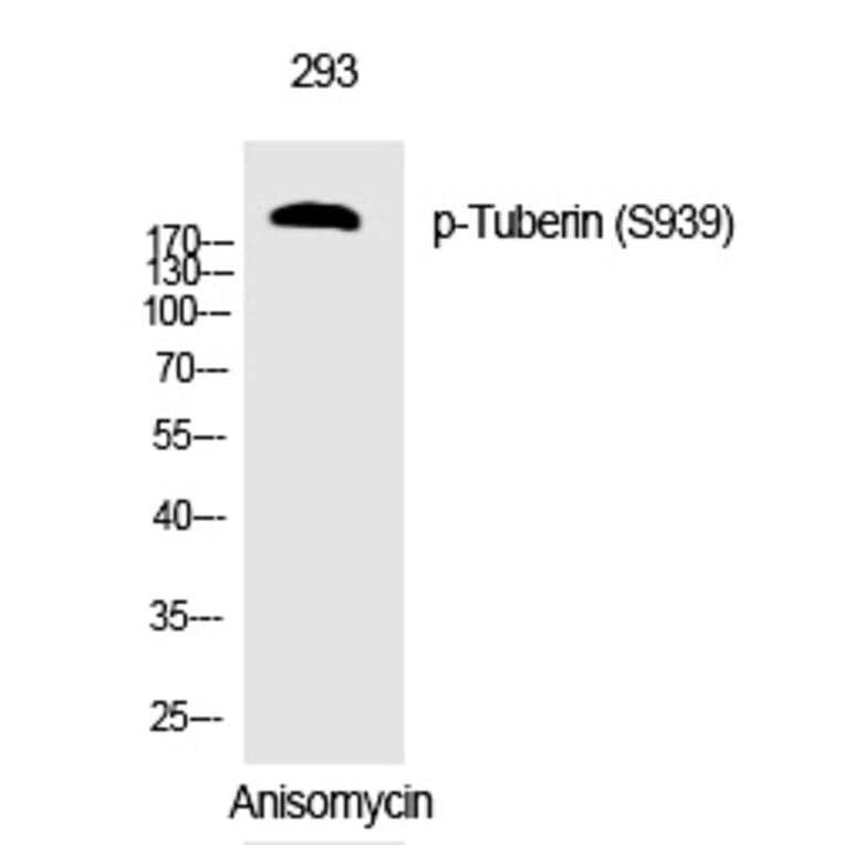 Western blot - Tuberin (Phospho-Ser939) Polyclonal Antibody from Signalway Antibody (12308) - Antibodies.com